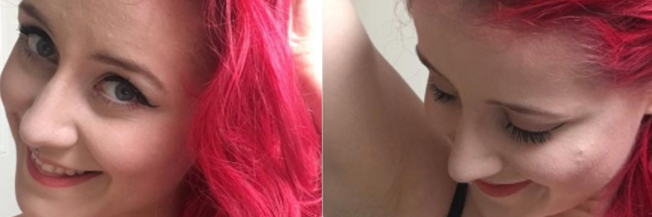 Milli Smith, SelfLoveClubb, Shares Instagram of Hair Loss Photo of Milli Smith