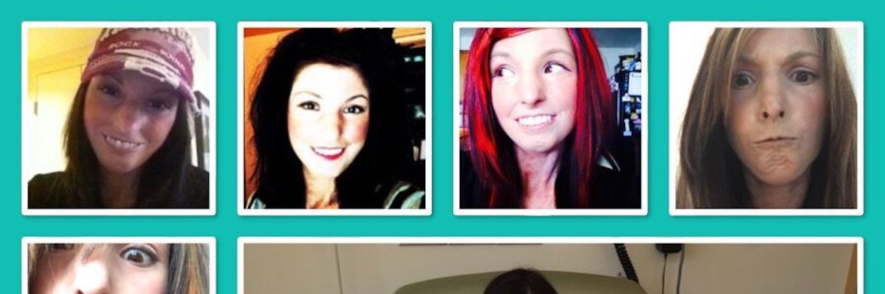 When People Laugh at My Hands That Were Damaged by Scleroderma collage of photos of amy gietzen with the caption 'the many faces of scleroderma'