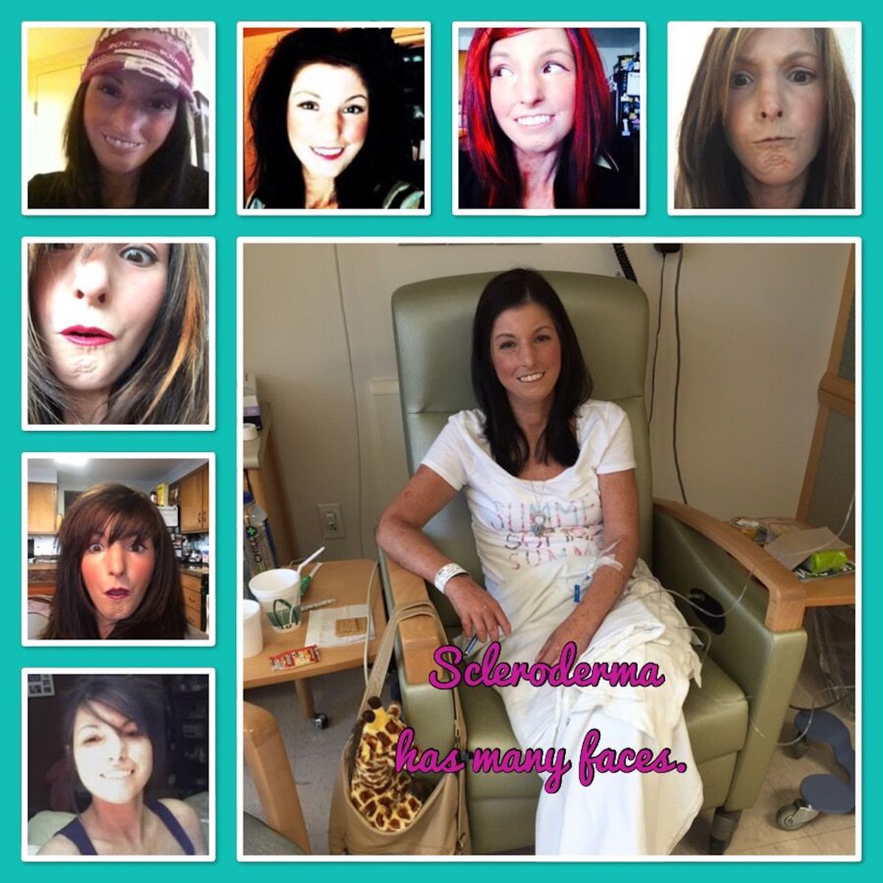 collage of photos of amy gietzen with the caption 'the many faces of scleroderma'