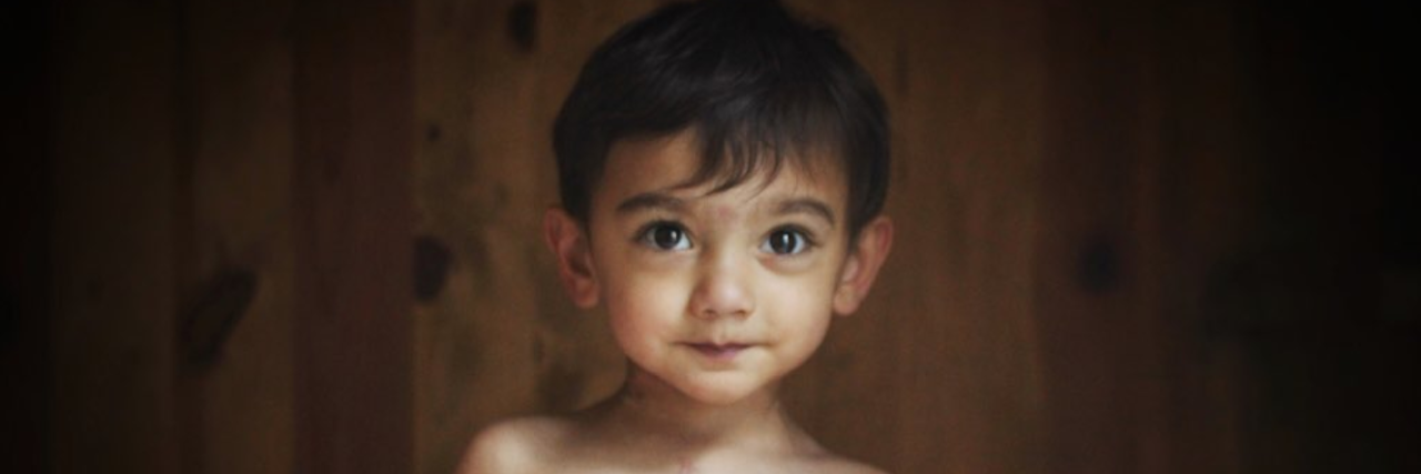 You Might Relate to This Mom's Viral Tweets About Lifetime Limits If Your Child Is Sick little boy with scar from heart surgery