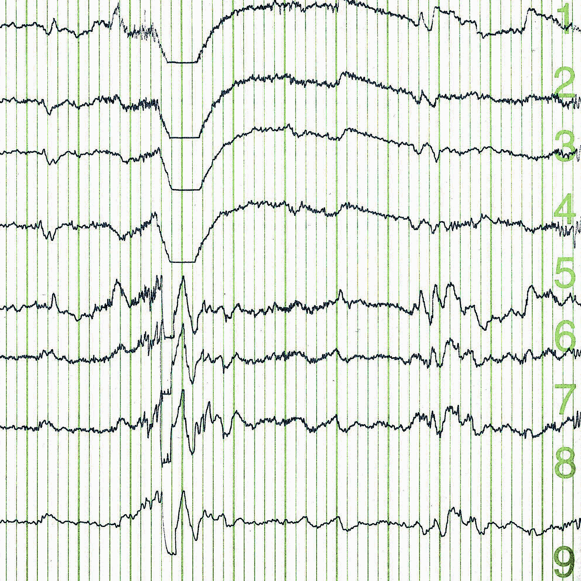 EEG brain wave.