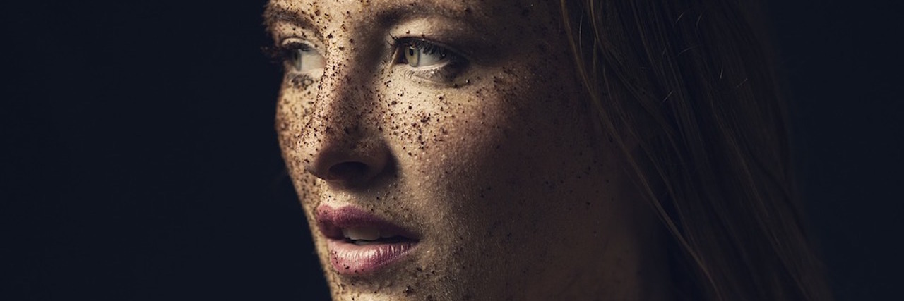 What It's Like to Have Mast Cell Activation Disorder (MCAD) woman covered in dirt smiling