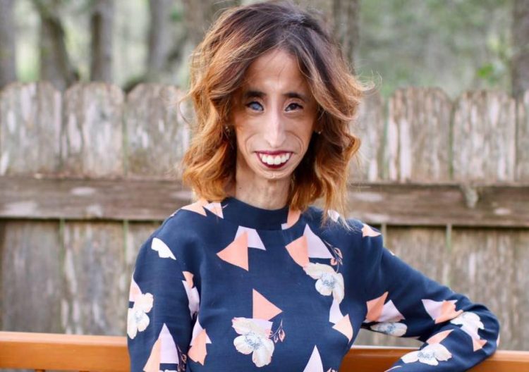 lizzie velasquez