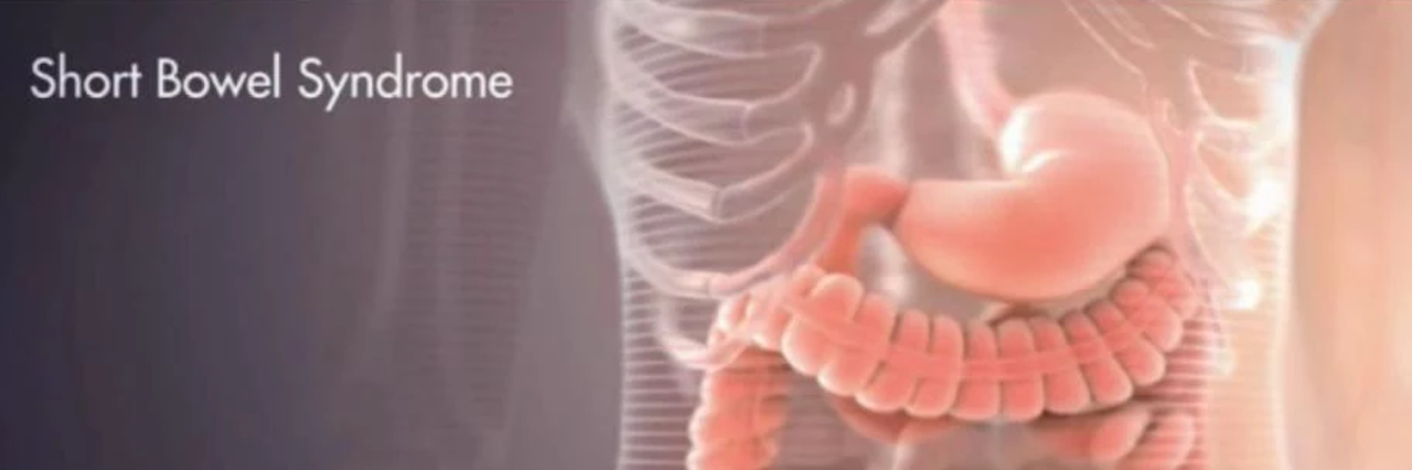 Truths About Living With Short Bowel Syndrome (SBS)