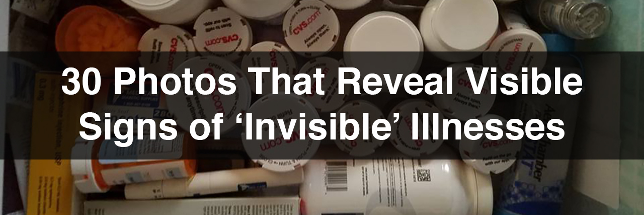 30 Photos That Reveal Visible Signs of Invisible Illness