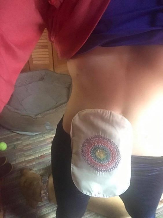 woman taking a photo of her ostomy bag