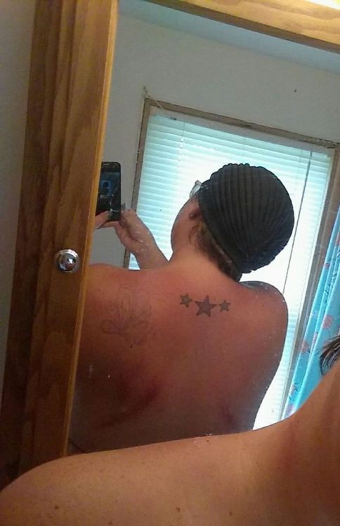 woman's back after having gua sha done with her massage