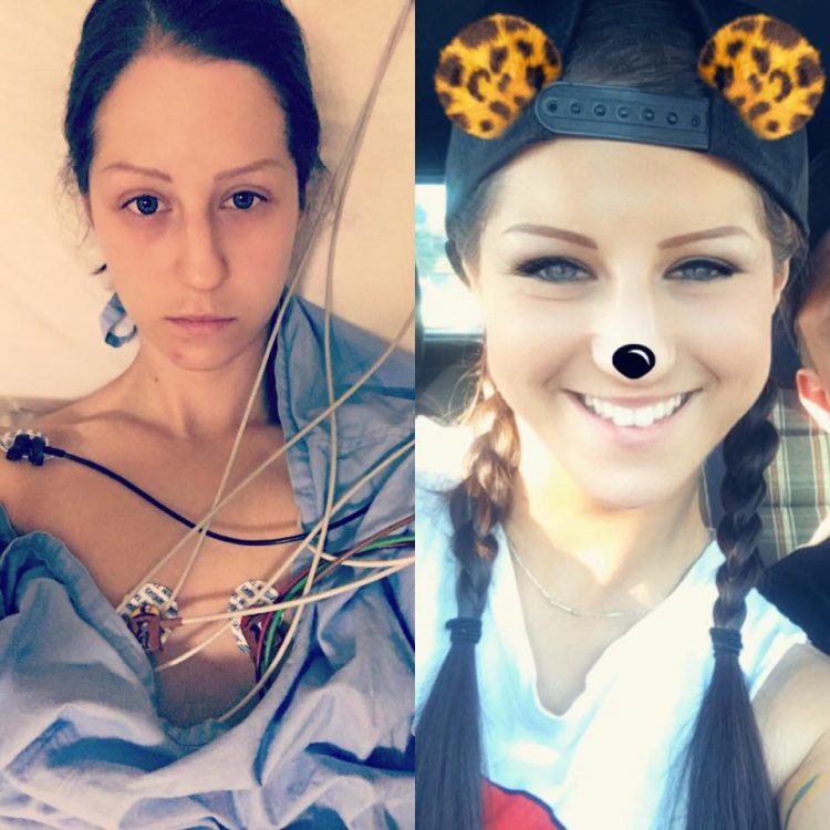 side by side photos of a woman in the hospital and a woman out and about wearing makeup with a snapchat filter