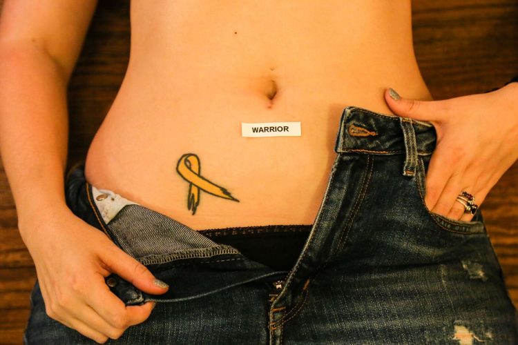 woman with her jeans unzipped to reveal her endometriosis awareness ribbon tattoo on her lower abdomen and a sticker on her stomach that says 'warrior'