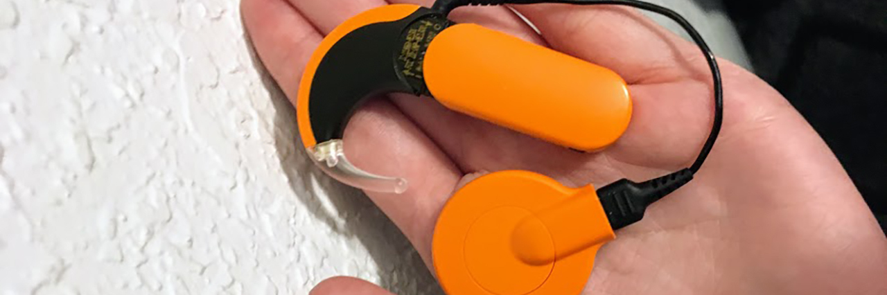 What It's Like to Get a Cochlear Implant as a Young Adult Chloe's cochlear implant processor.