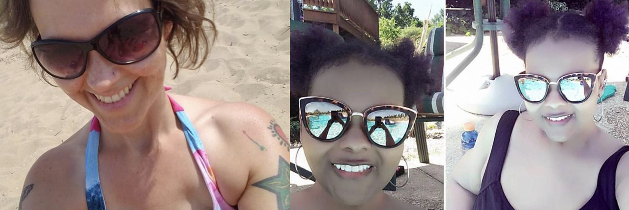 Going to the Beach With a Chronic Illness Photo of a woman with mastectomy scars and another woman in a black bathing suit and sun glasses
