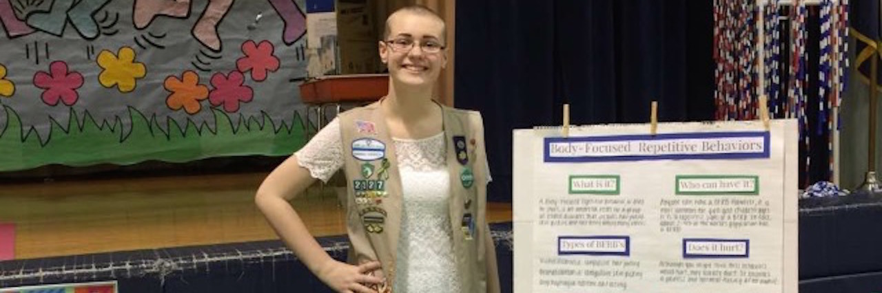 How I Made the Most of My Experience With Trichotillomania