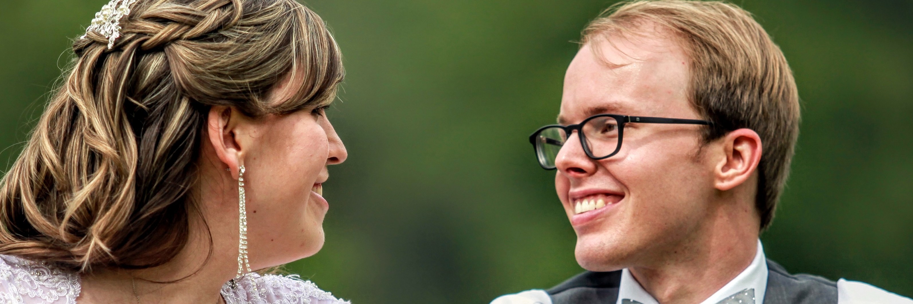 Why I'm Flaunting My Bruises From My Medical Treatments A bride and groom on their wedding day, the bride showing her bruise on her arm.