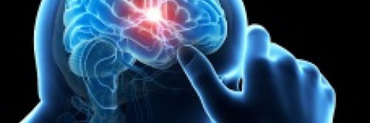 Symptoms and Side Effects of Migraine computerized image of a person having a migraine