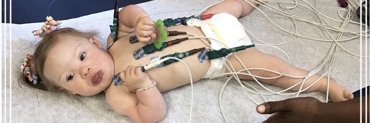 My Daughter With Down Syndrome Had Open-Heart Surgery