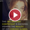 This 'Big Brother' Contestant Is Showing Viewers the Reality of Her Chronic Illness