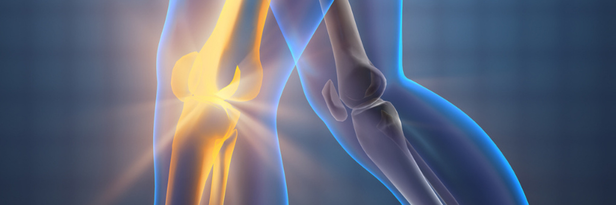 Wishing Others Could See Invisible Pain With Fibromyalgia x-ray view of a person walking with pain in their knee