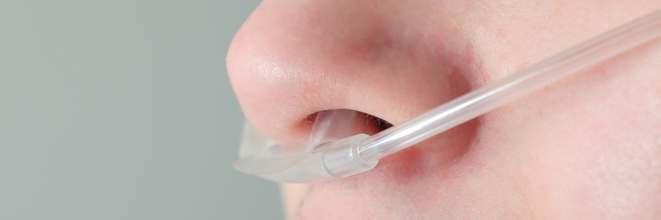 A young patient with an oxygen tube in their nose.