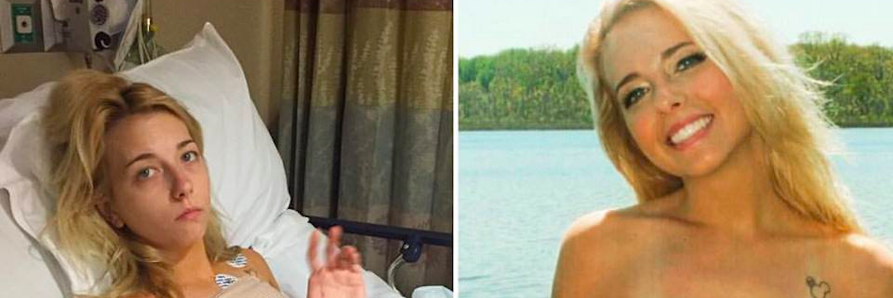 Our Health Conditions Are Not Competitions Two photos side by side of the same woman, one where she is ill and in a hospital bed looking pale - another where she is enjoying the beach in her tan and swimsuit.