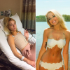Two photos side by side of the same woman, one where she is ill and in a hospital bed looking pale - another where she is enjoying the beach in her tan and swimsuit.