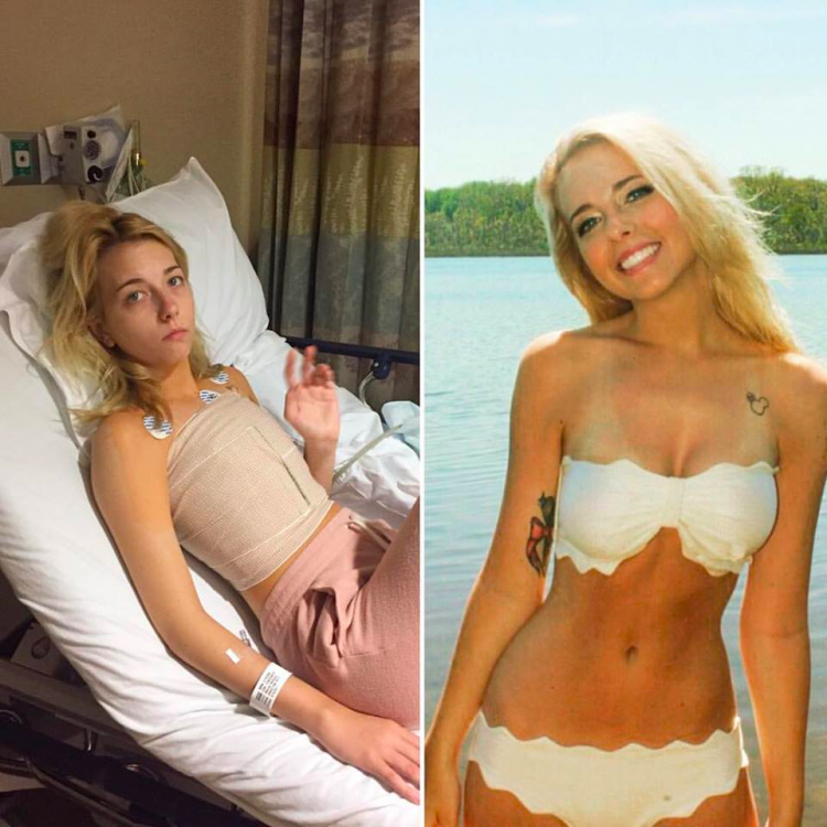 Two photos side by side of the same woman, one where she is ill and in a hospital bed looking pale - another where she is enjoying the beach in her tan and swimsuit. 