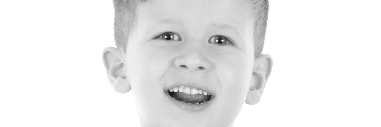 The Worry I Feel as My Child With a Disability Takes School Transport