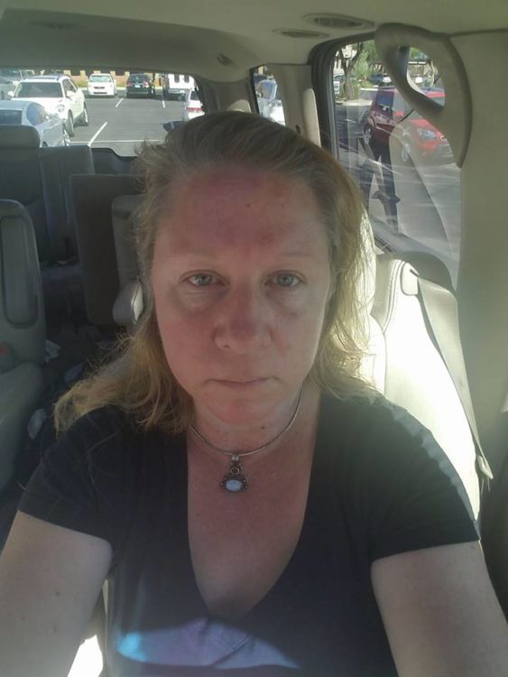woman sitting in her car with a red face from botox treatment