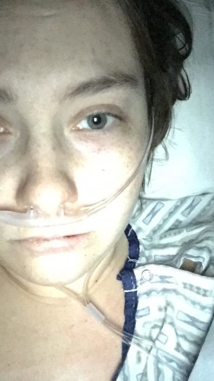 woman lying in a hospital bed after surgery with a breathing tube in her nose