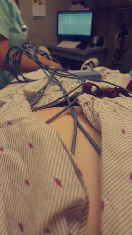 woman in the hospital with wires all over her chest