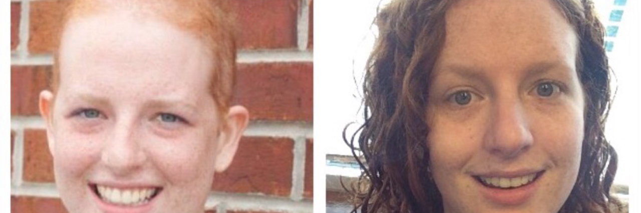 This Is Why I Want to Break the Cancer Stereotype before and after photo of female cancer survivor