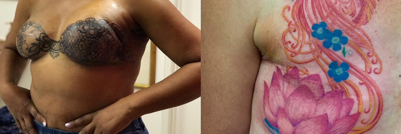 Tattoo Artists Turning Breast Cancer Scars Into Works of Art Breast Cancer Tattoo Feature