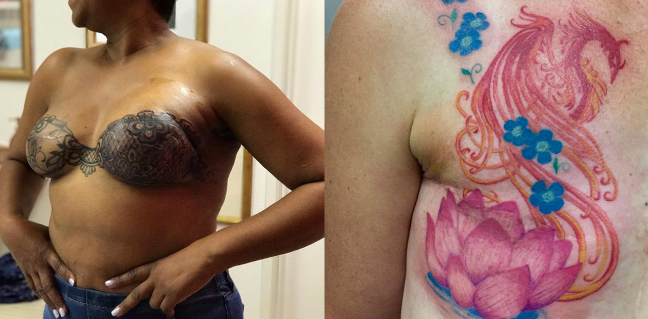 6 Tattoo Artists Turning Breast Cancer Scars Into Works of Art