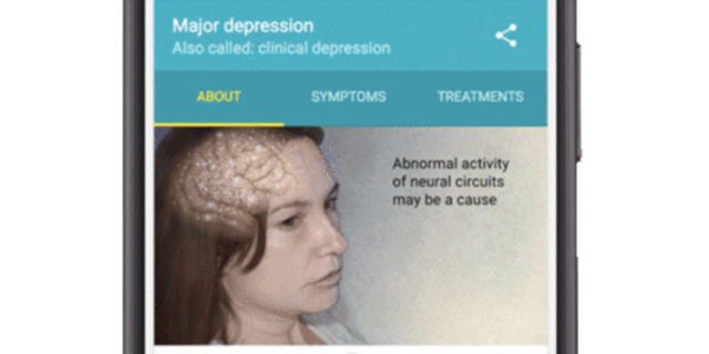 Image of google results for when you search depression. Shows a woman with her brain as an overlay and explains that depression may be caused by abnormal brain activity.