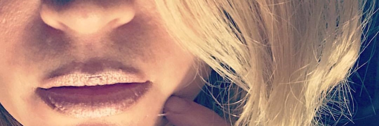 Ehlers-Danlos Syndrome, Chronic Pain: Not Comparing Yourself to Others