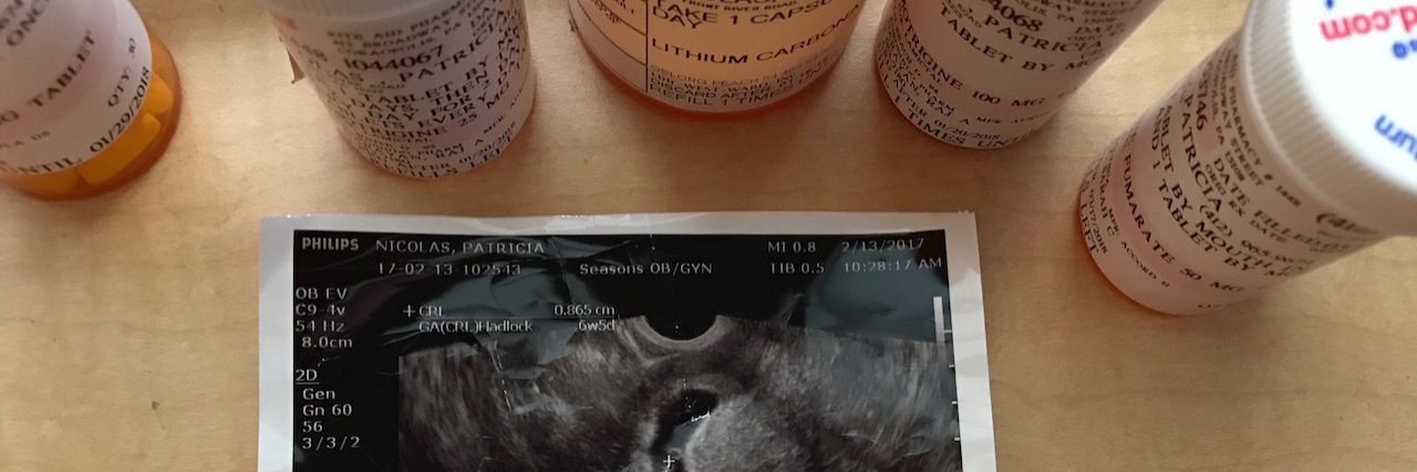 Managing Pregnancy and Bipolar Disorder a ultasound image next to pills