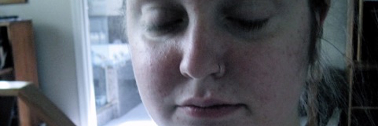 Photo of Woman During Lupus Flare Shows What Illness Can Look Like woman during lupus treatment with tape on her chest and a tattoo on her shoulder