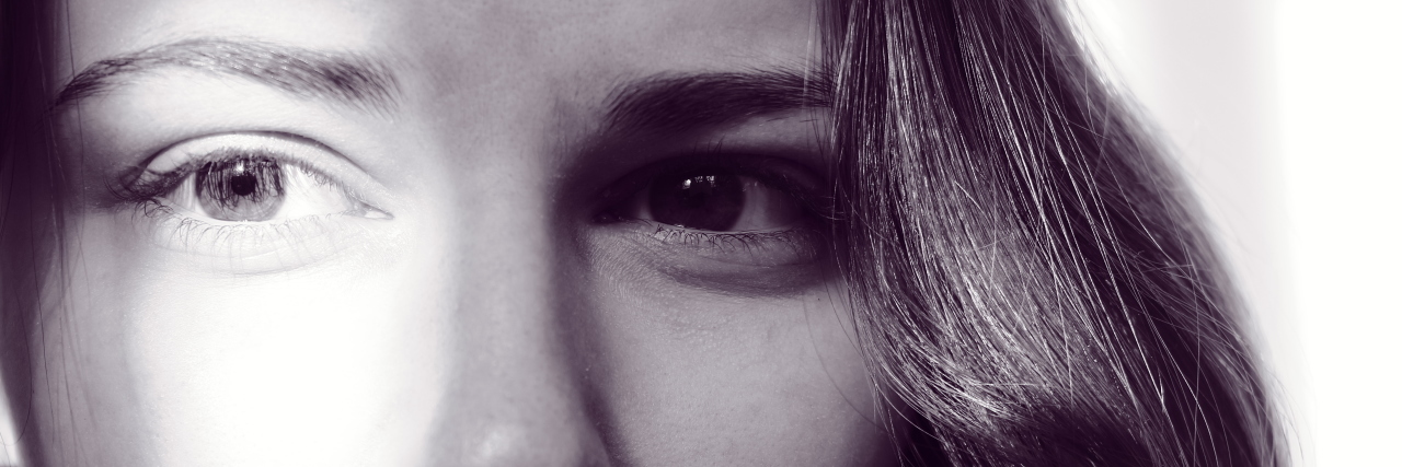 Ehlers-Danlos: Staying Positive, Not Admitting Defeat After Pain Flare black and white photo of a woman's face