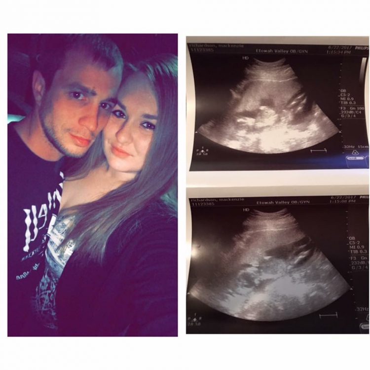 photo of a woman and her partner next to two ultrasound photos of her baby