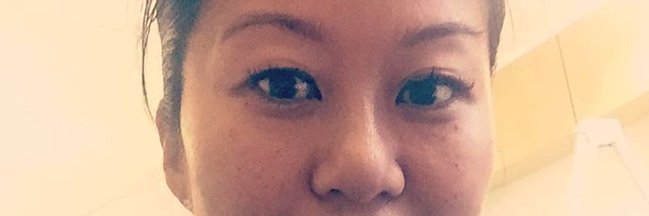 This Is What It's Like to Have Thyroid Cancer and Still Love Life Line Peter Patient Photo