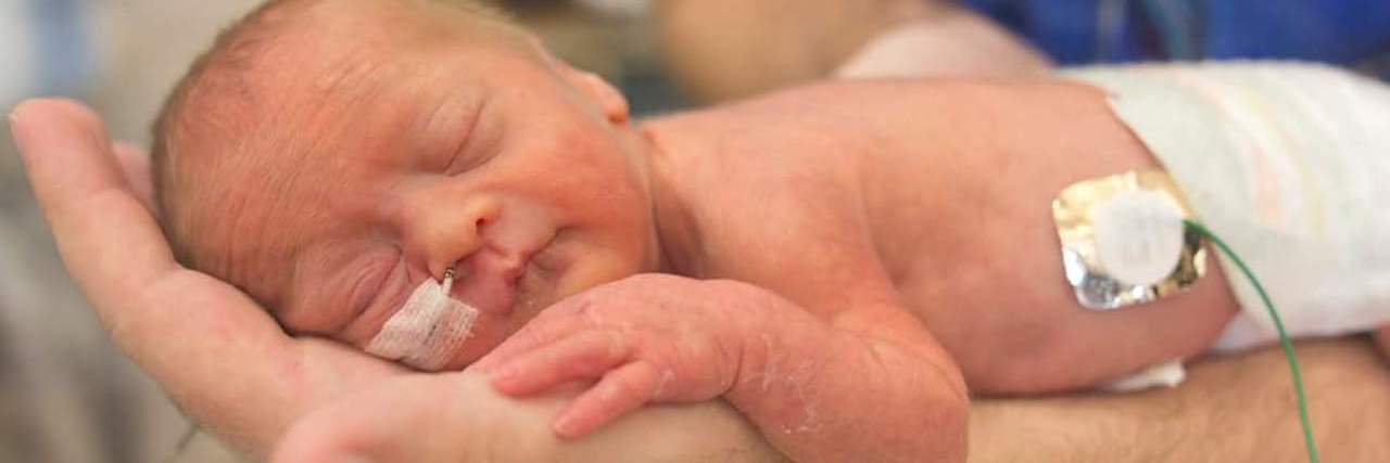 What I Learned About Myself After My Son's Down Syndrome Diagnosis Baby with down syndrome with ntube and sleeping on dad's arms.