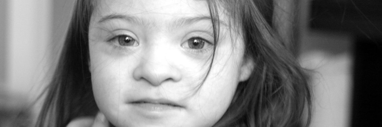 Black and white image of girl with Down syndrome -- closeup