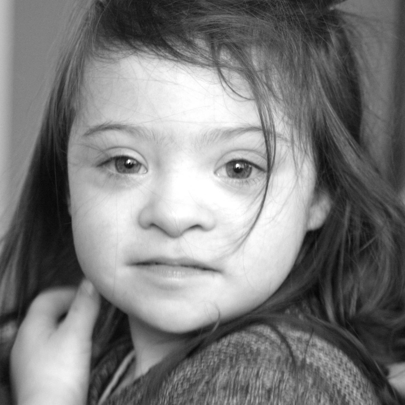 Black and white image of girl with Down syndrome -- closeup