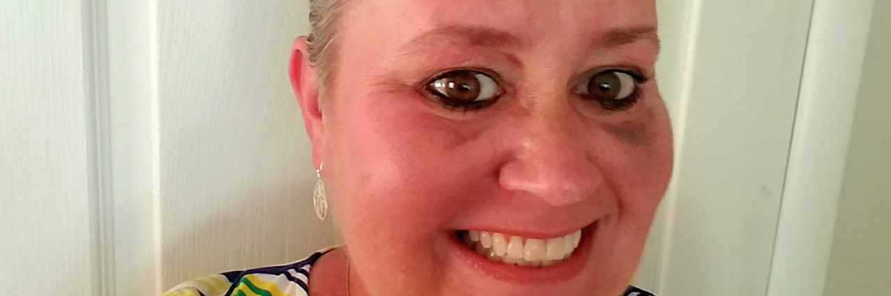 This Common Myth Led a Spa to Refuse a Woman With Breast Cancer Service woman with breast cancer close up photo