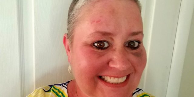 This Common Myth Led a Spa to Refuse a Woman With Breast Cancer Service woman with breast cancer close up photo