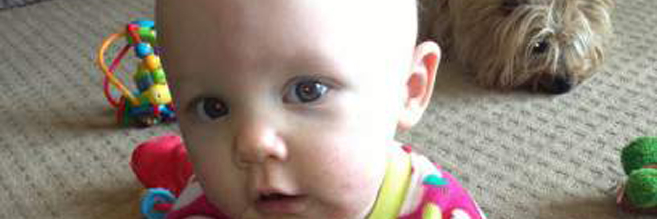 This Was the Reality of My Baby's Brain Cancer young pediatric patient sitting on floor