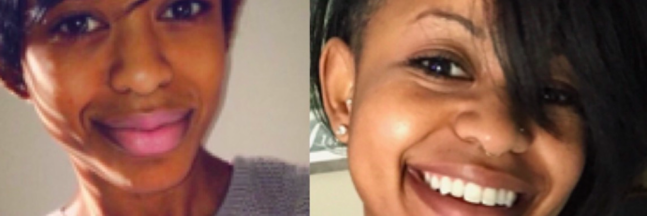 Why I Didn't Know I Was Struggling With an Eating Disorder woman