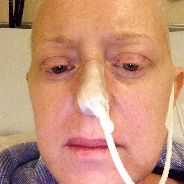 cancer patient with NG tube