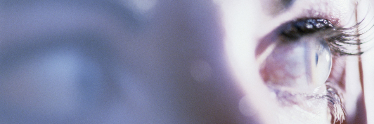 Cerebral Palsy and Hypersensitivity: the Challenges of Middle Age Close up portrait of woman's eye looking anxious.