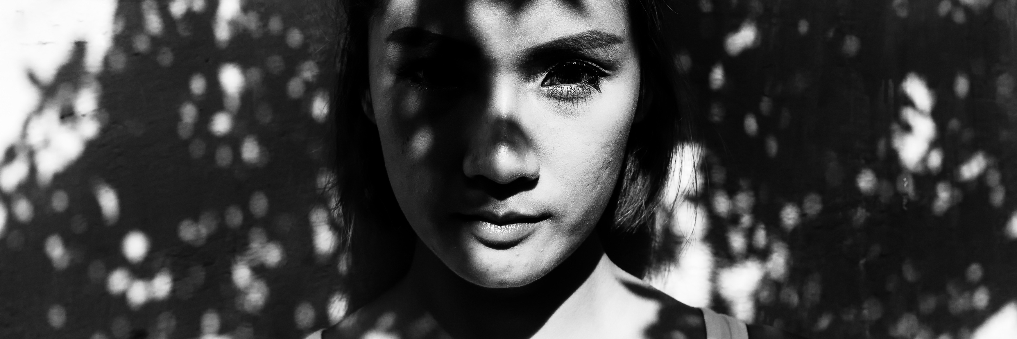 Why Pulmonary Hypertension Isn’t an Invisible Illness to Me Young woman standing in tree shadows