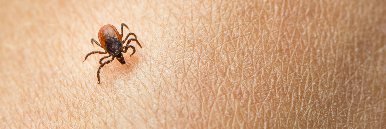 What New York State Task Force on Tick-Borne Diseases Should Address tick on a person's skin